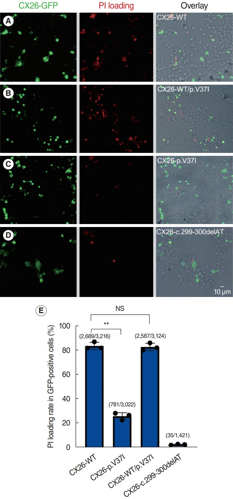 Deficient Gap Junction Coupling in Two Common Hearing Loss-Related Variants of GJB2.