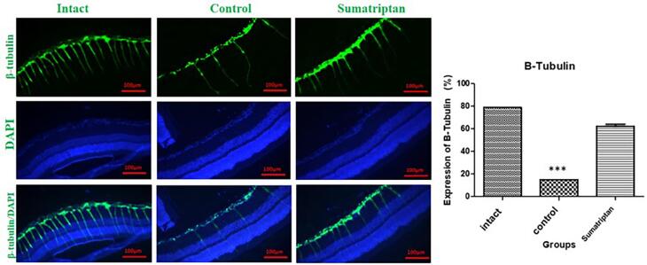 Protective effects of sumatriptan against optic nerve injury in rats via modulation of kynurenine pathway, oxidative stress and apoptosis.