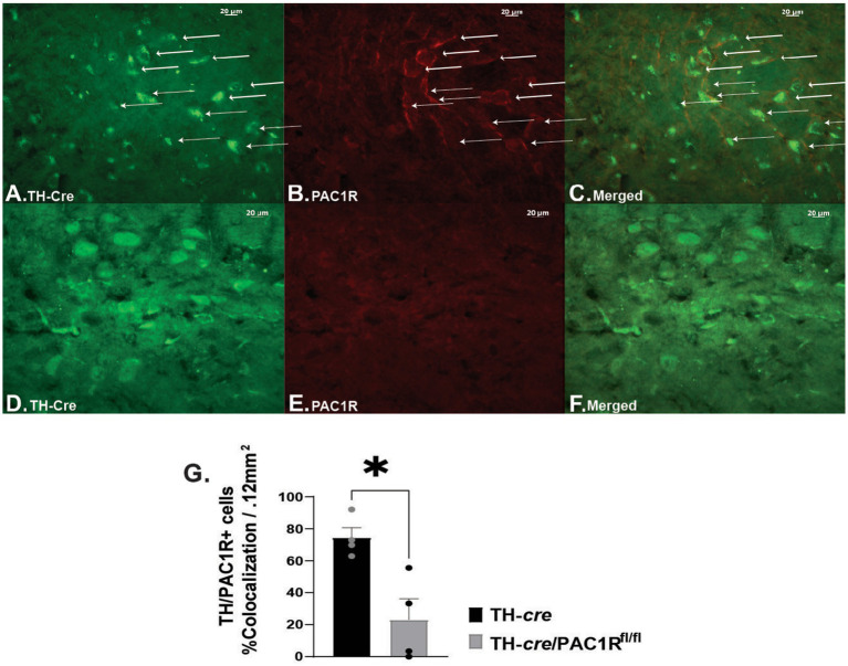 The role of pituitary adenylate cyclase-activating polypeptide neurons in the hypothalamic ventromedial nucleus and the cognate PAC1 receptor in the regulation of hedonic feeding.