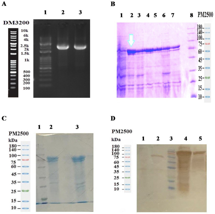 Anticancer and bioactivity effect of the AraA-IL13 fusion protein on the glioblastoma cell line.