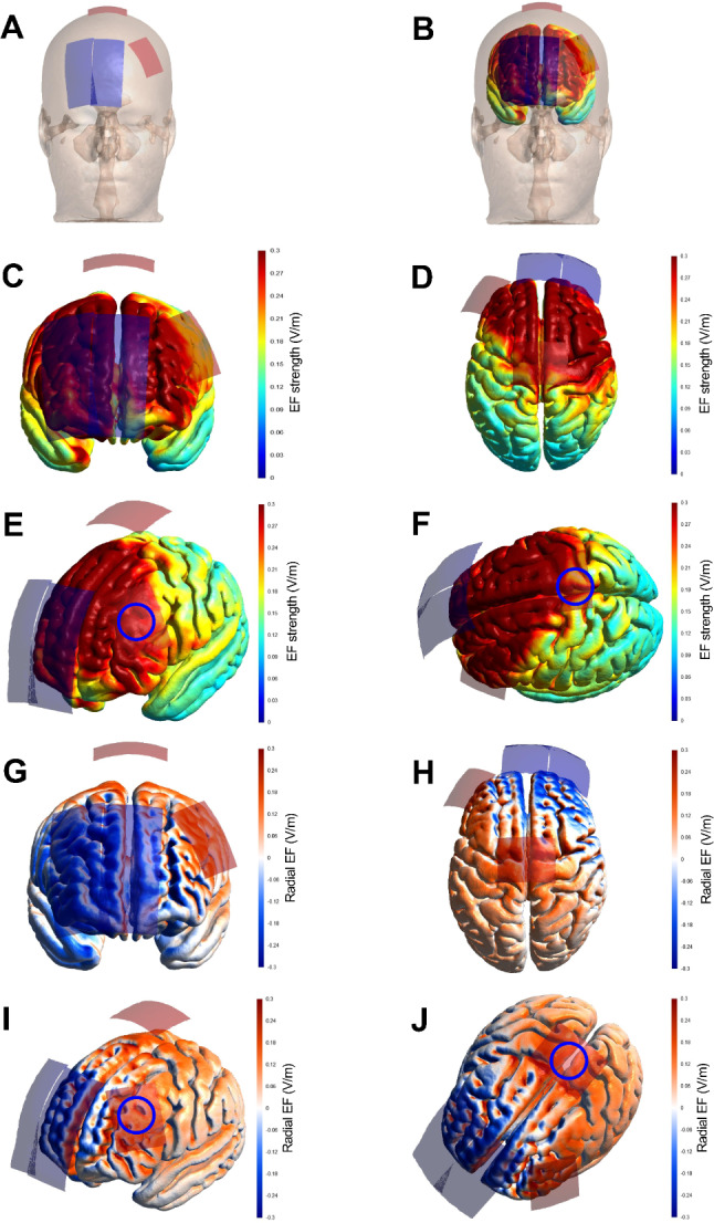 Effects of repeated unihemispheric concurrent dual-site tDCS and virtual reality games on motor coordination of sedentary adolescent girls.