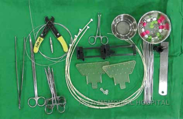 Indian Brachytherapy Society consensus recommendations for brachytherapy in breast cancer.
