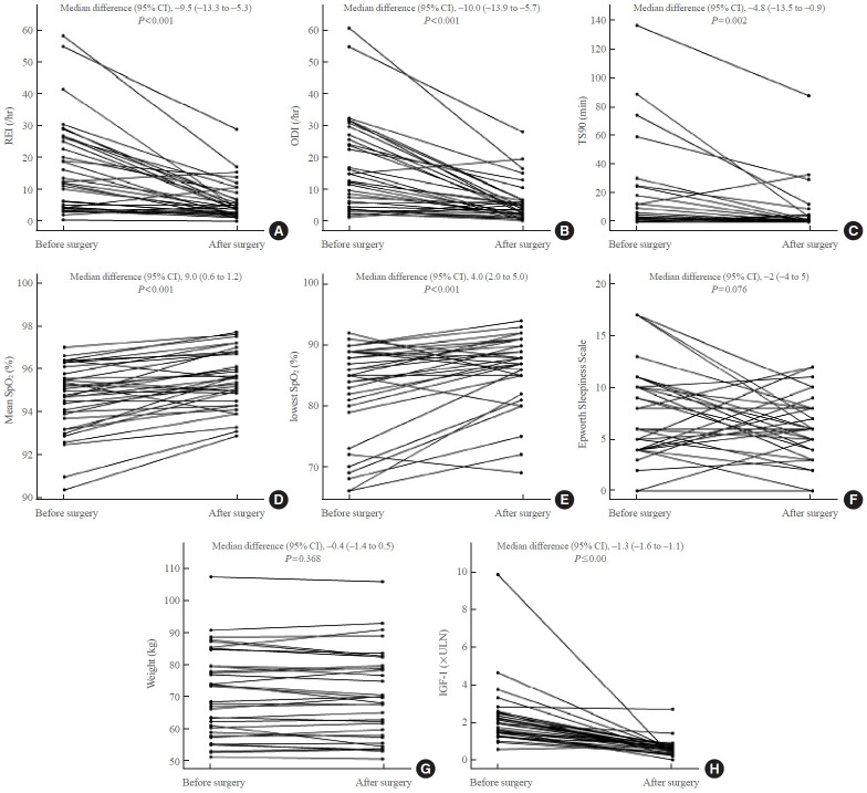 Obstructive Sleep Apnea Screening and Effects of Surgery in Acromegaly: A Prospective Study.