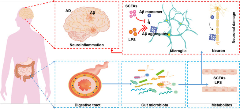 Trajectory of brain-derived amyloid beta in Alzheimer's disease: where is it coming from and where is it going?