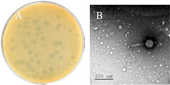 Proteomic analysis of carbapenem-resistant Klebsiella pneumoniae outer membrane vesicles under the action of phages combined with tigecycline.