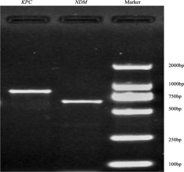 Proteomic analysis of carbapenem-resistant Klebsiella pneumoniae outer membrane vesicles under the action of phages combined with tigecycline.