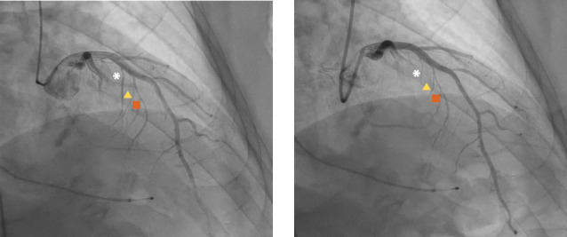 Modern Perspectives on Hypertrophic Cardiomyopathy-No One Size Fits All.
