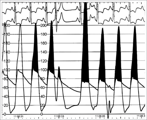 Modern Perspectives on Hypertrophic Cardiomyopathy-No One Size Fits All.
