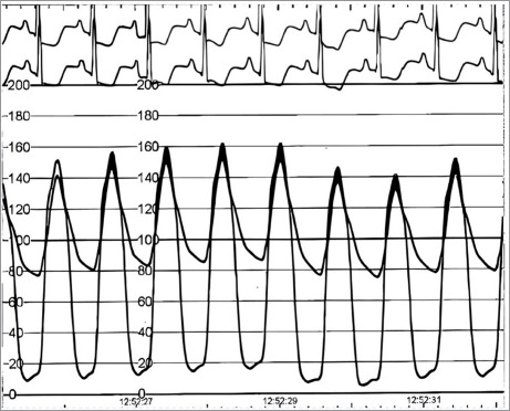 Modern Perspectives on Hypertrophic Cardiomyopathy-No One Size Fits All.