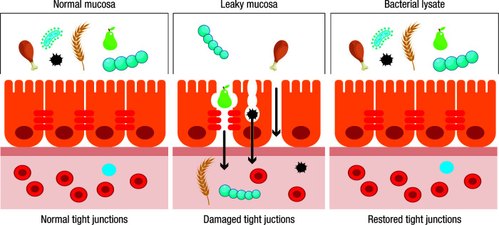 Sublingually administered bacterial lysates: rationale, mechanisms of action and clinical outcomes.