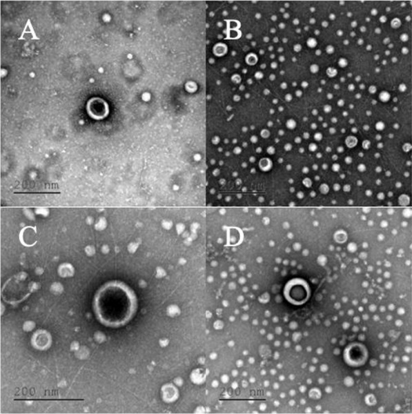 Proteomic analysis of carbapenem-resistant Klebsiella pneumoniae outer membrane vesicles under the action of phages combined with tigecycline.