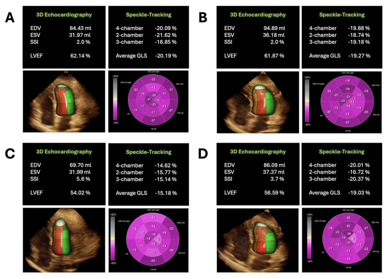 Cancer Therapy-Related Cardiac Dysfunction: Strategies for Enhancing Cardiac Recovery.