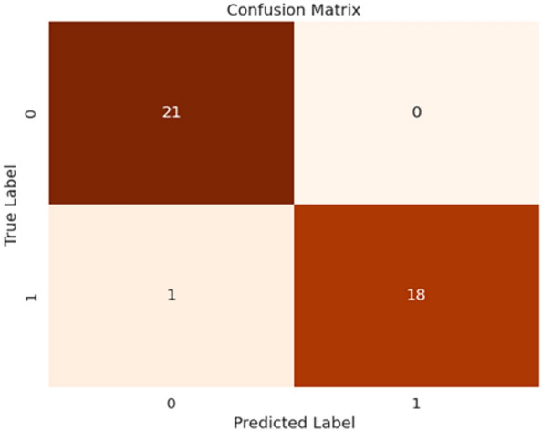 HyEpiSeiD: a hybrid convolutional neural network and gated recurrent unit model for epileptic seizure detection from electroencephalogram signals.