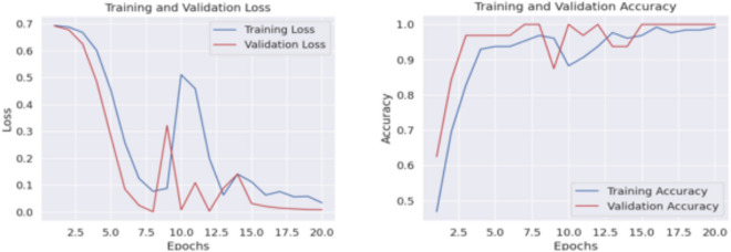 HyEpiSeiD: a hybrid convolutional neural network and gated recurrent unit model for epileptic seizure detection from electroencephalogram signals.
