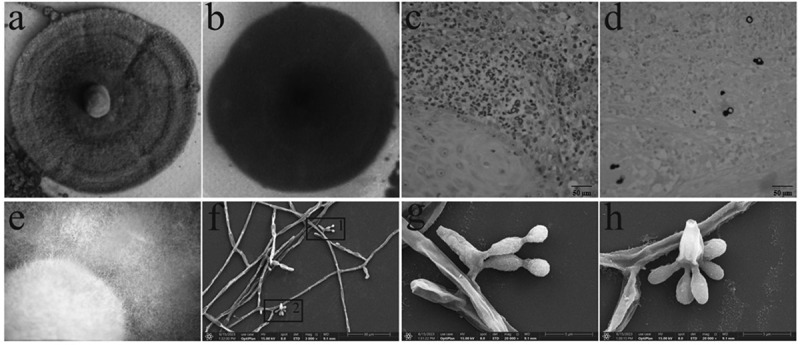 Improving treatment of chromoblastomycosis: the potential of COP1T-HA and antimicrobial photodynamic therapy against <i>Fonsecaea monophora in vitro</i>.
