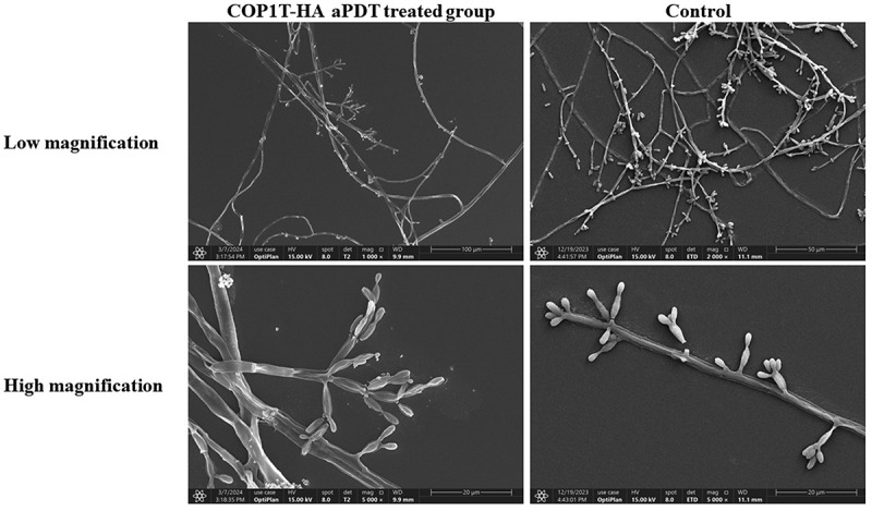 Improving treatment of chromoblastomycosis: the potential of COP1T-HA and antimicrobial photodynamic therapy against <i>Fonsecaea monophora in vitro</i>.