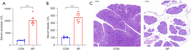 Systematic metabolic profiling of mice with caerulein-induced acute pancreatitis.