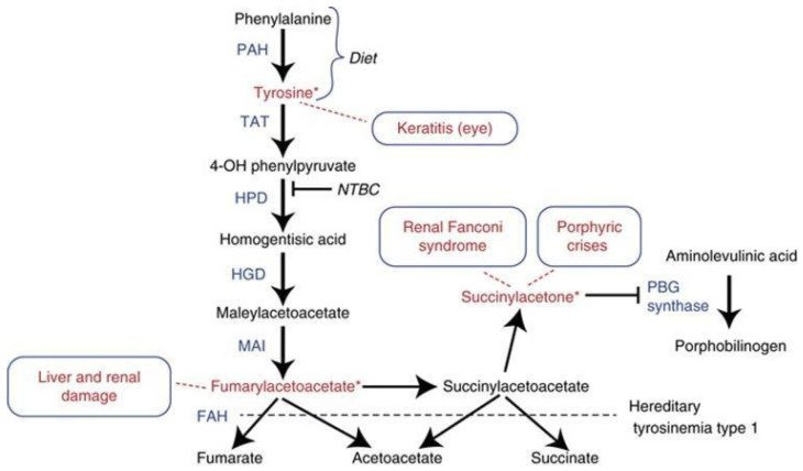 Clinical, Biochemical, and Molecular Characteristics of Filipino Patients with Tyrosinemia Type 1.
