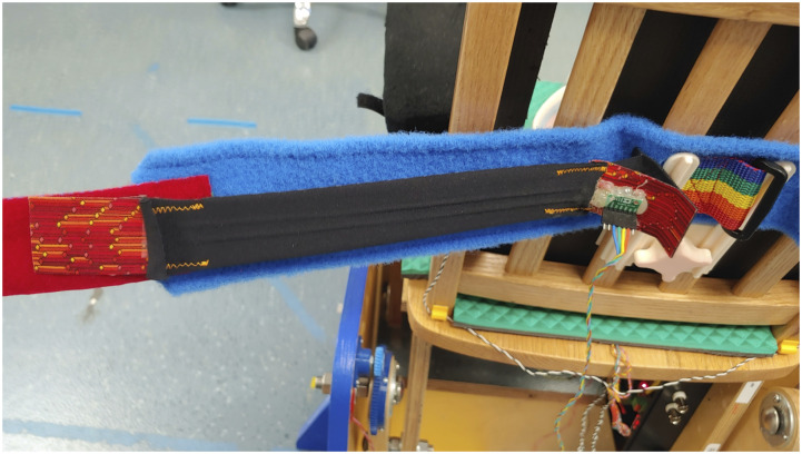 Monitoring muscle activity in pediatric SCI: Insights from sensorized rocking chairs and machine-learning.