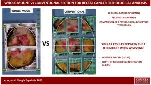 A comparison of whole-mount and conventional sections for pathological mesorectal extension and circumferential resection margin assessment after total mesorectal excision