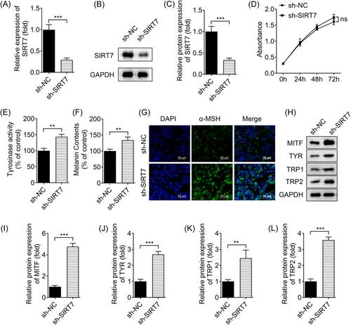 Mechanism of desuccinylation of G6PD mediated by SIRT7 to promote vitiligo disease progression