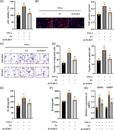 17β-estradiol promotes the progression of temporomandibular joint osteoarthritis by regulating the FTO/IGF2BP1/m6A-NLRC5 axis