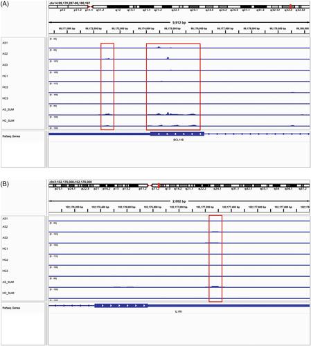 Identification of key genes with abnormal RNA methylation modification and selected m6A regulators in ankylosing spondylitis