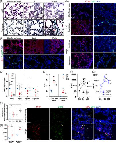 Post-COVID pulmonary injury in K18-hACE2 mice shows persistent neutrophils and neutrophil extracellular trap formation