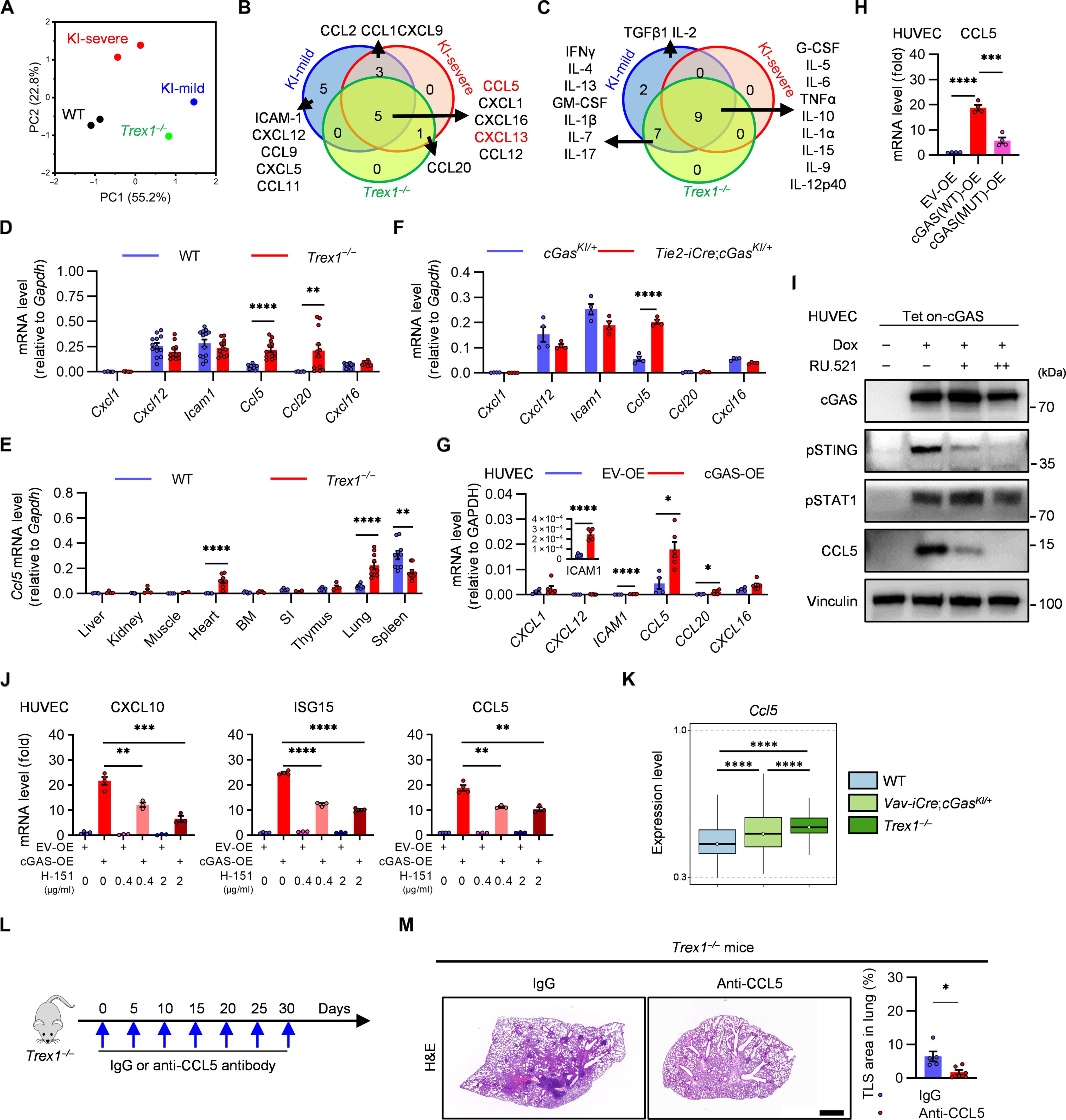 cGAS-activated endothelial cell–T cell cross-talk initiates tertiary lymphoid structure formation