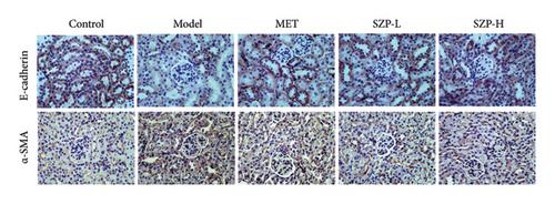 Sanziguben Polysaccharides Attenuate Renal Epithelial-Mesenchymal Transition in Diabetic Nephropathy through Nrf2-Mediated Regulation of TGF-β1/Smad7 Signaling Pathway