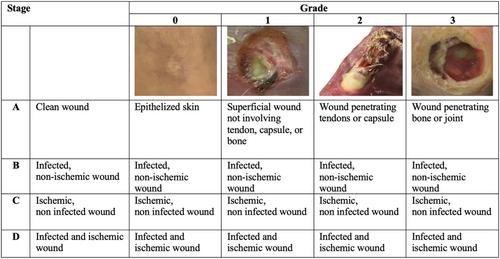 Effects of Rheopheresis in dialysis patients with peripheral artery disease and diabetic foot ulcers: A multicentric Italian study