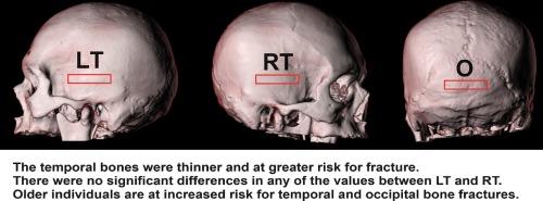 Assessment of differences in mechanical properties and thickness of temporal and occipital bones and correlation with age in Japanese forensic samples