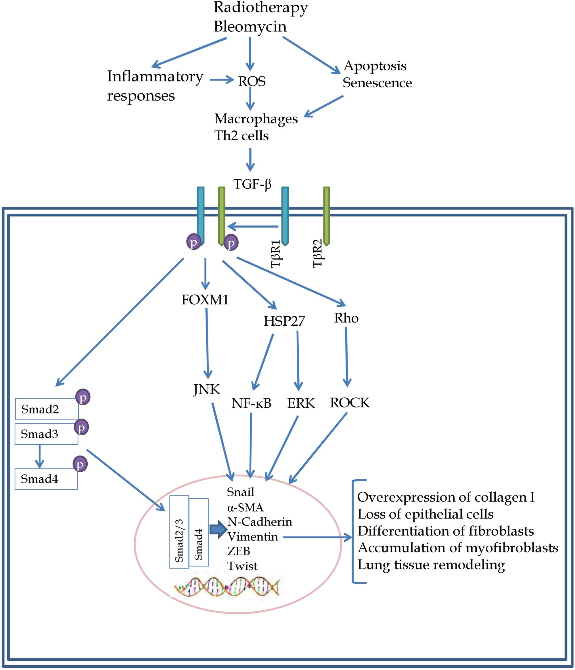 Epithelial–mesenchymal transition in chemoradiation-induced lung damage: Mechanisms and potential treatment approaches