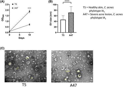 Pro-inflammatory activity of Cutibacterium acnes phylotype IA1 and extracellular vesicles: An in vitro study