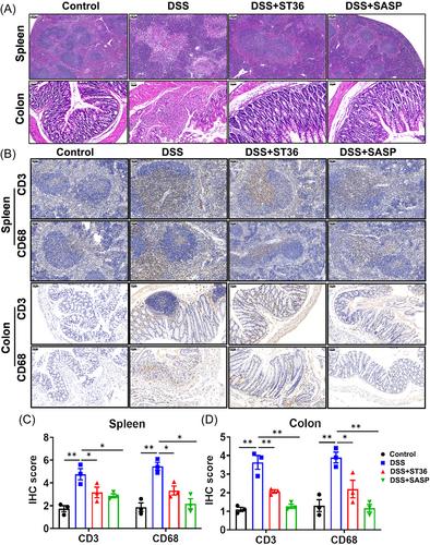 Electroacupuncture at Zusanli regulates the pathological phenotype of inflammatory bowel disease by modulating the NLRP3 inflammasome pathway