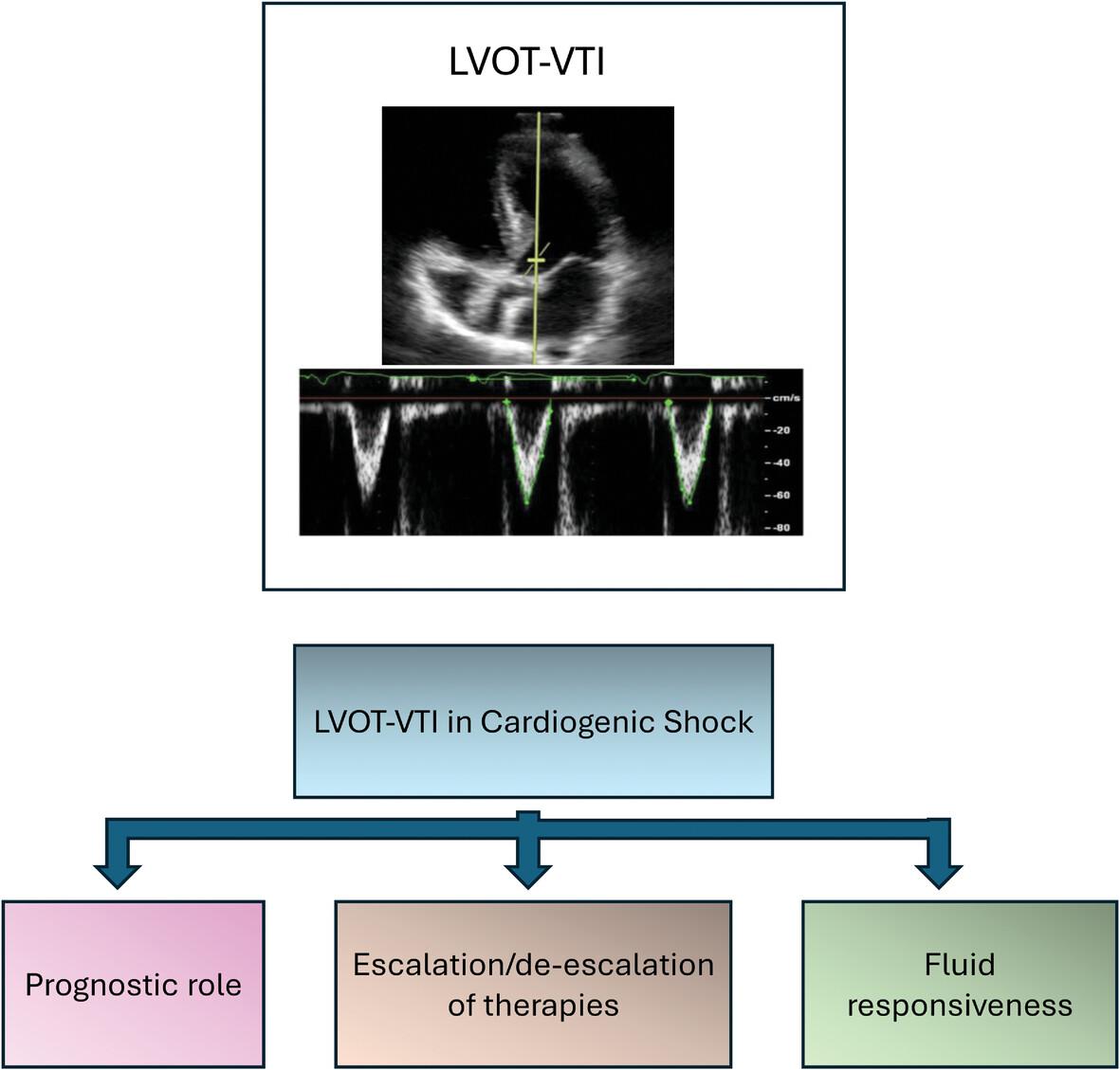 Assessing aortic flow with doppler echocardiography in cardiogenic shock: A crucial diagnostic tool