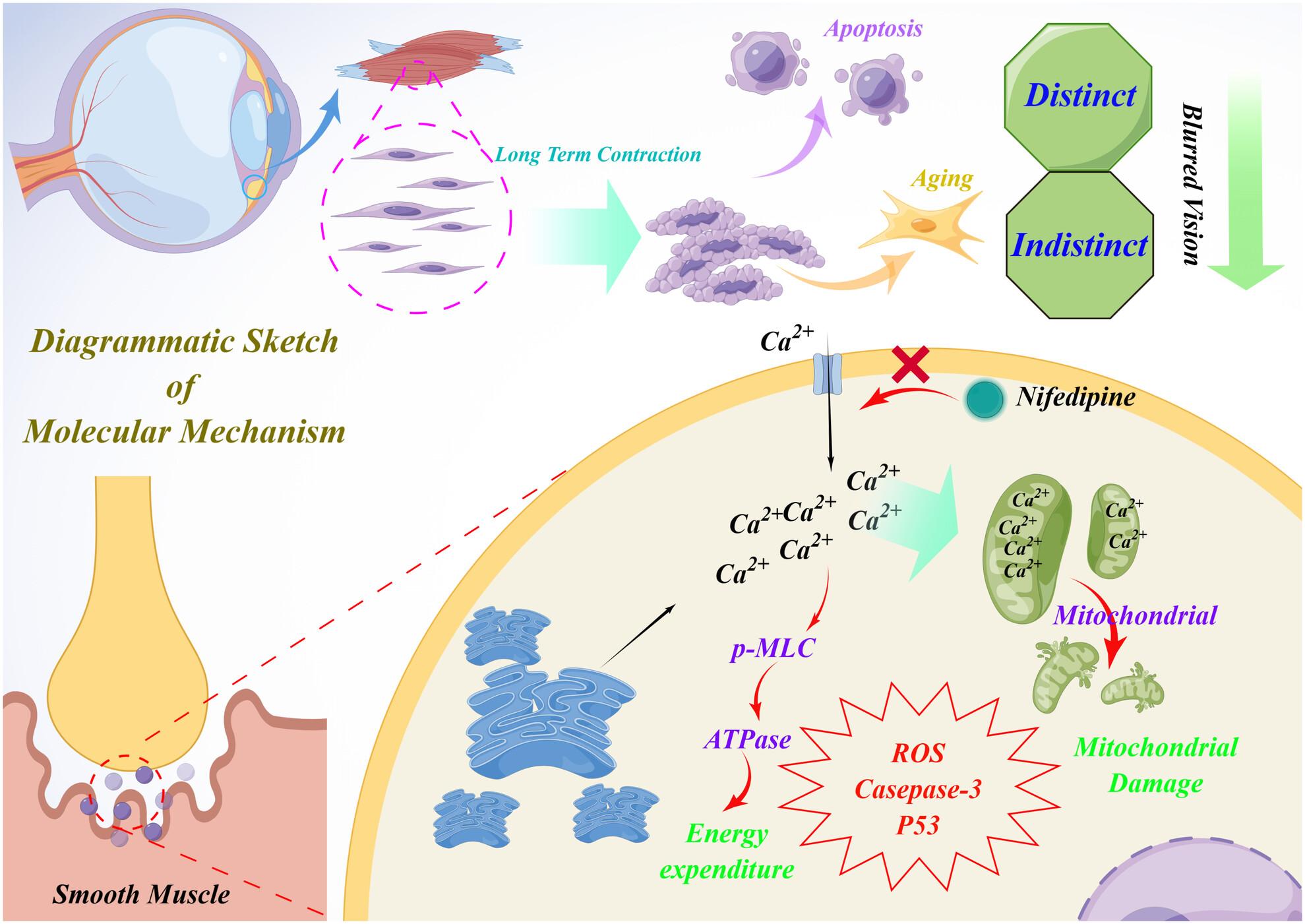 Pilocarpine mediated excessive calcium accumulation leads to ciliary muscle cell senescence and apoptosis