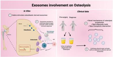 Osteoblasts-derived exosomes as potential novel communicators in particle-induced periprosthetic osteolysis