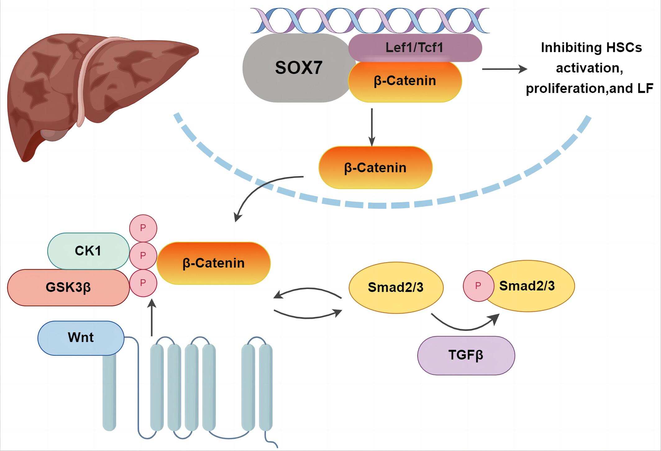 System analysis based on weighted gene co-expression analysis identifies SOX7 as a novel regulator of hepatic stellate cell activation and liver fibrosis