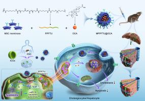 ROS-responsive nanoparticle delivery of obeticholic acid mitigate primary sclerosing cholangitis