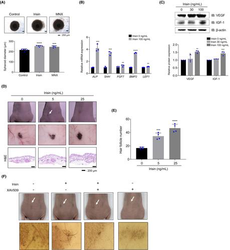 Irisin promotes hair growth and hair cycle transition by activating the GSK-3β/β-catenin pathway