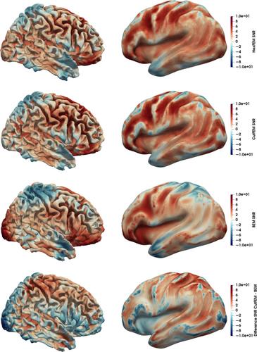 CutFEM-based MEG forward modeling improves source separability and sensitivity to quasi-radial sources: A somatosensory group study