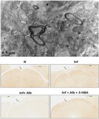 Benzaldehyde stimulates autophagy via the sonic hedgehog signaling pathway in mouse brain astrocytes after treatment with Angiostrongylus cantonensis excretory-secretory products