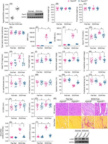 Phosphoglycerate mutase 5 exacerbates alcoholic cardiomyopathy in male mice by inducing prohibitin-2 dephosphorylation and impairing mitochondrial quality control