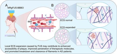 Ultrasound-enabled delivery of drugs to the brain: Thinking outside the blood–brain barrier