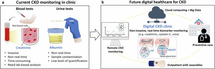 Wearable sensors for monitoring chronic kidney disease