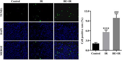 Baicalein Enhances Radiosensitivity in Colorectal Cancer via JAK2/STAT3 Pathway Inhibition