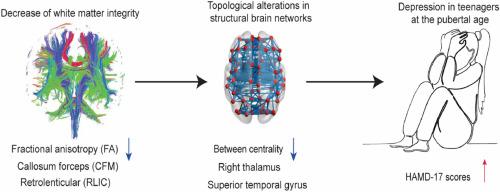 Regional brain structural network topology mediates the associations between white matter damage and disease severity in first-episode, Treatment-naïve pubertal children with major depressive disorder