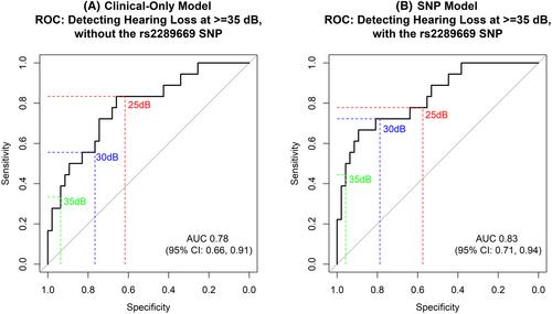 The role of genetic variants in the prediction of hearing loss due to cisplatin chemoradiotherapy