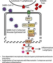 Necroptosis in alveolar epithelial cells drives lung inflammation and injury caused by SARS-CoV-2 infection